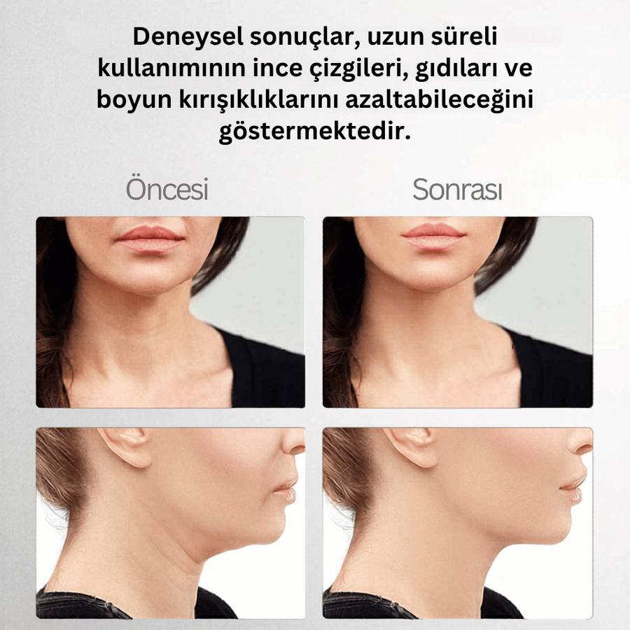 Yüz Bakım Cihazı - düzenli kullanımda ince çizgi ve gıdı görünümünde azalma